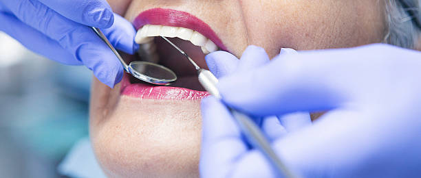 Best Broken or Chipped Tooth Repair in Arcadia, FL